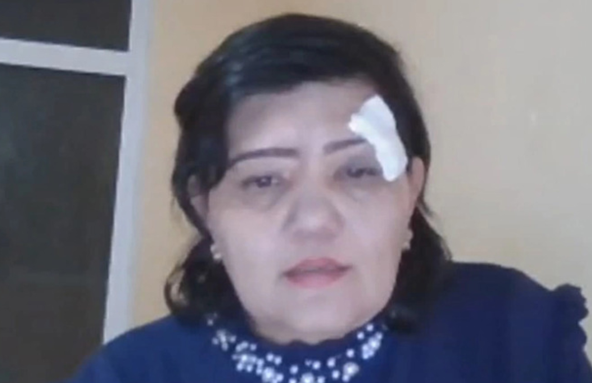 В Андижане возбудили уголовное дело по факту избиения блогера Фатимы Джураевой