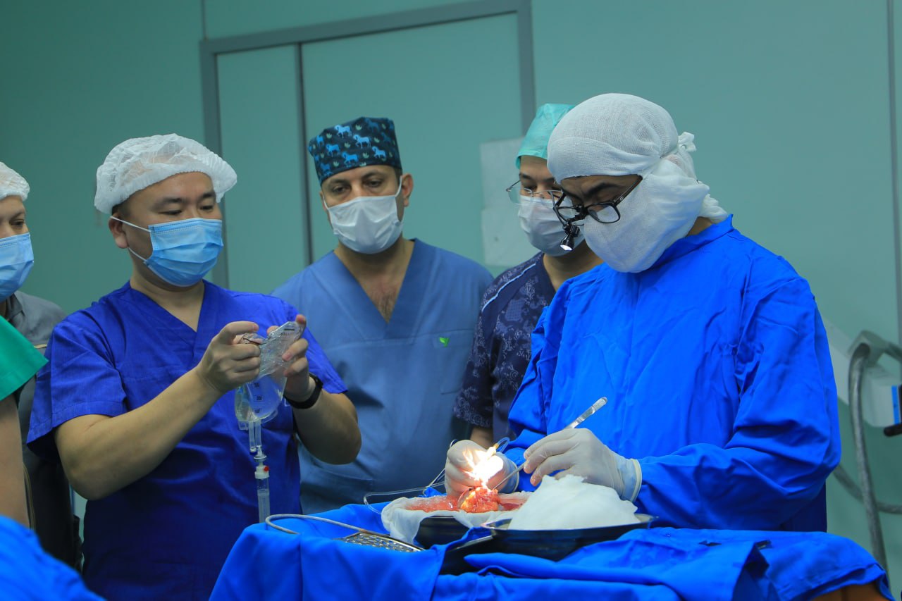 В Бухаре первый раз провели операцию по пересадке почки