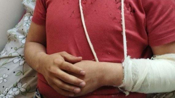 В Андижане сожитель пациентки с друзьями побили врача