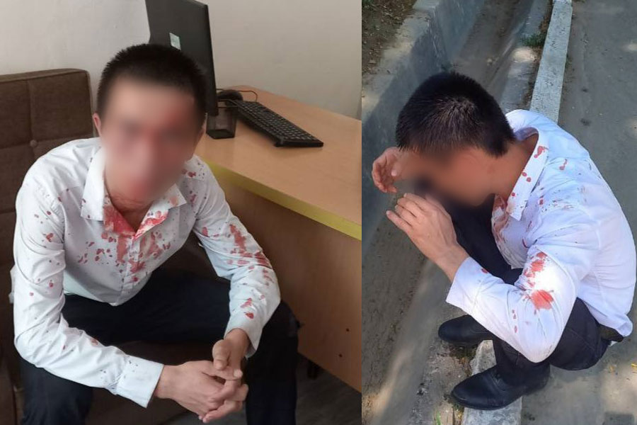 В Ташкенте школьники разбили лицо учителю информатики: мужчину увезла скорая