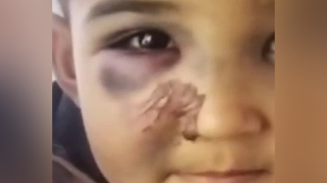 В Самаркандской области жестоко избили ребенка — видео