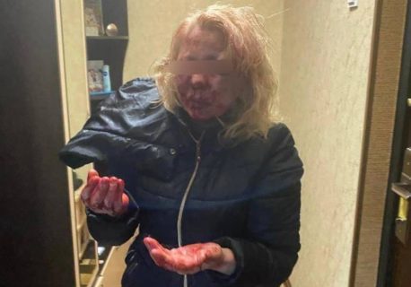 В Ташкенте пьяный мужчина жестоко избил сиделку матери