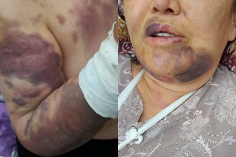 В Ташкенте помощника хокима подозревают в жестоком избиении матери
