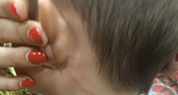 Детский омбудсман прокомментировал избиение трехлетнего ребенка в частном детсаду Хорезма
