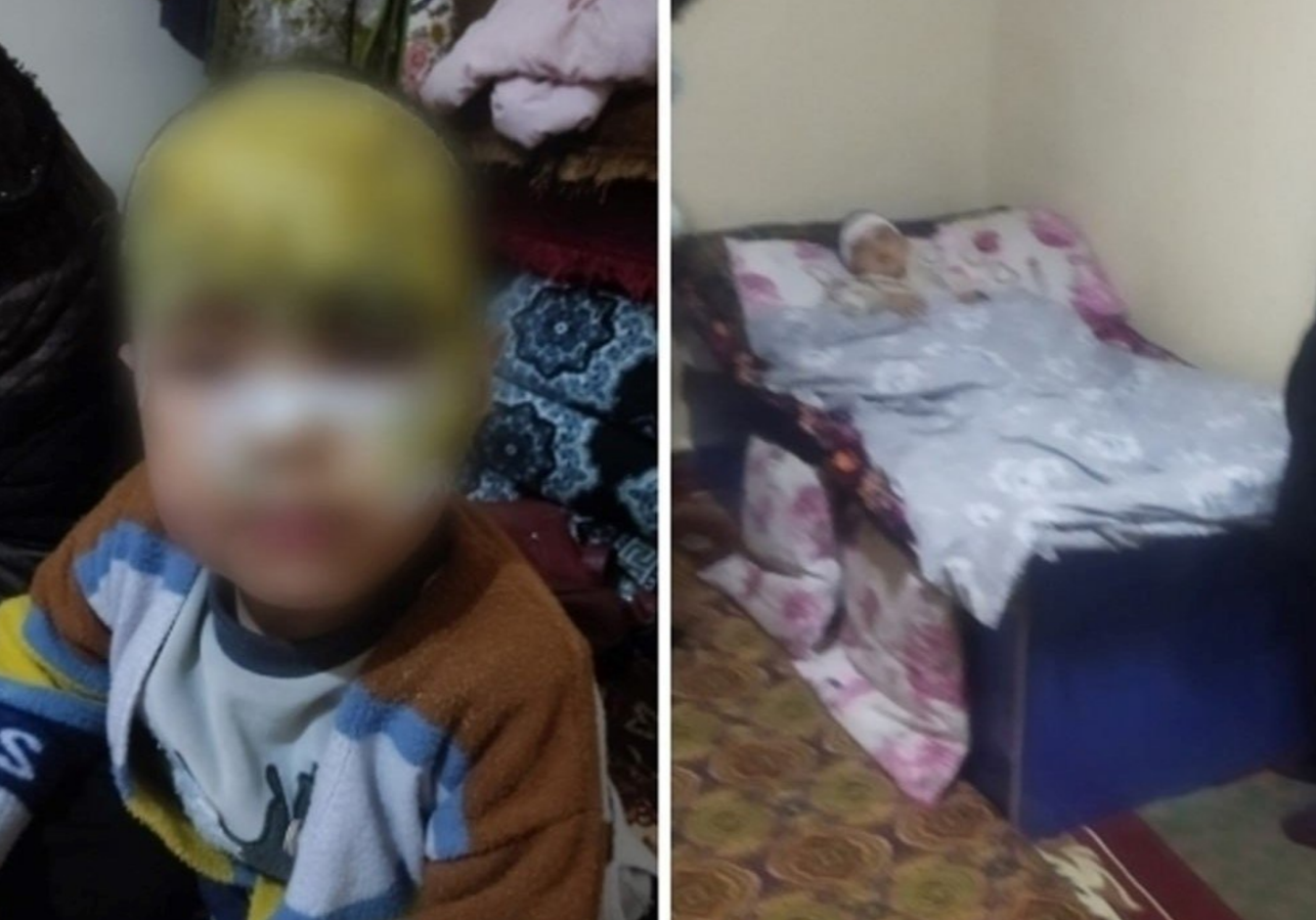 В Кашкадарье воспитательница нечаянно облила кипятком ребенка 1 В Кашкадарье воспитательница нечаянно облила кипятком ребенка