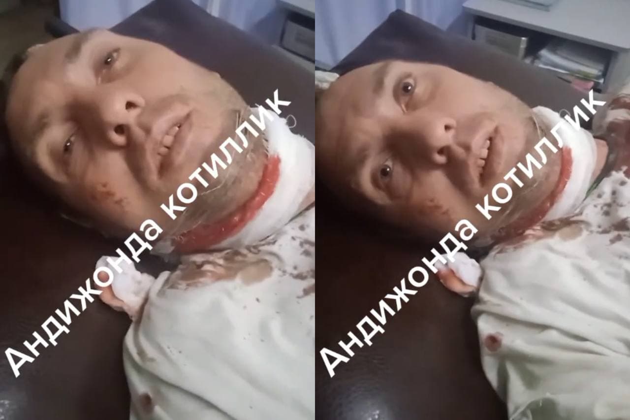 Узбекистанец поругался со своим знакомым и порезал ему шею — видео